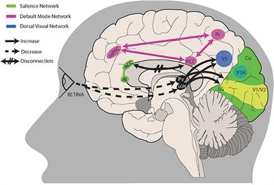 Imaging the <mark class="highlighted">Visual Network</mark> in the Migraine Spectrum